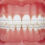 Fotografia ambulancie