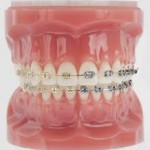 Fotografia ambulancie